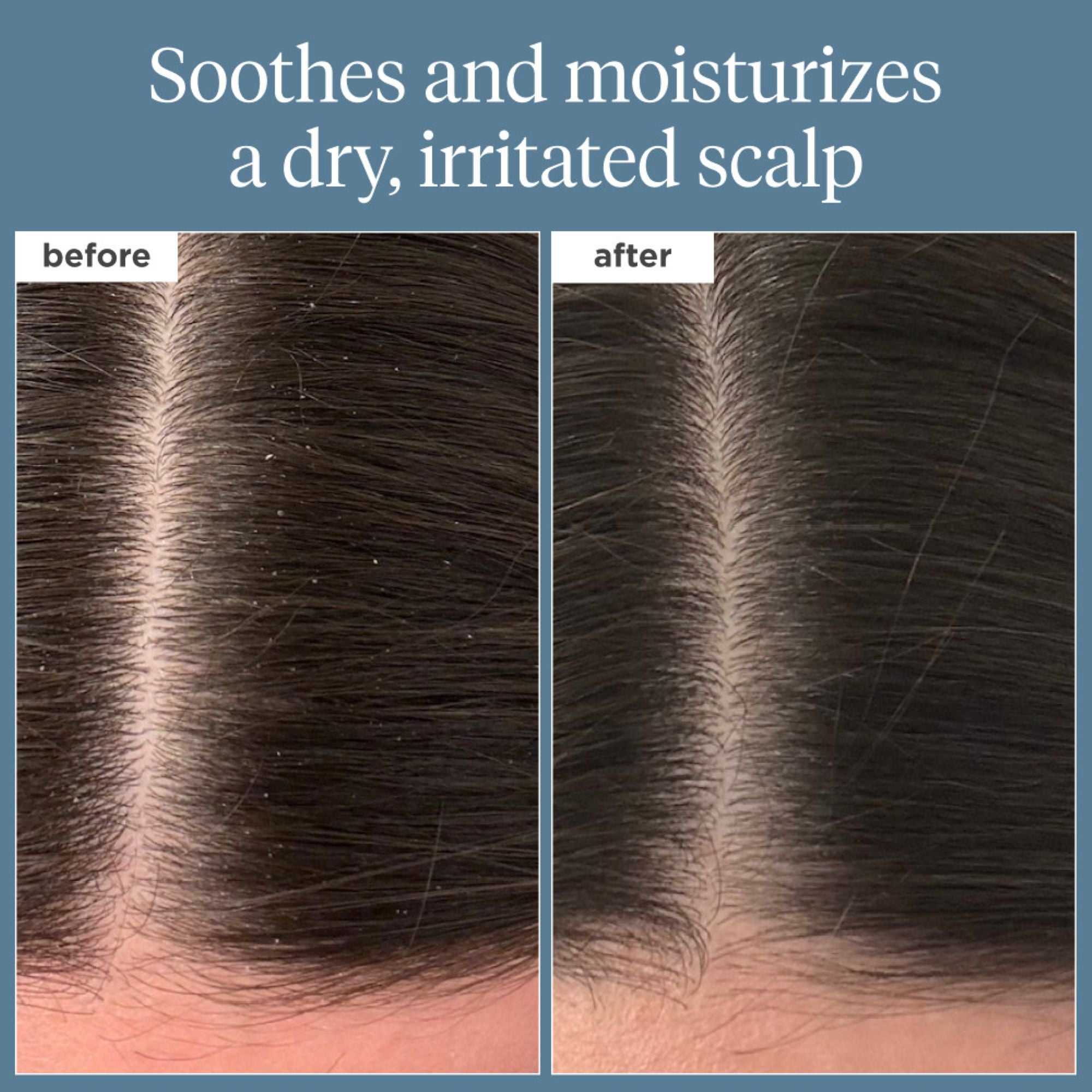 Briogeo Scalp Revival Rosemary Pre-Wash Oil