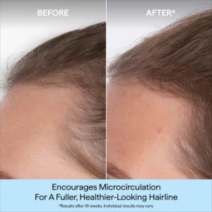 Briogeo Destined For Density MegaStrength+ Caffeine + Biotin Peptide Density Serum – mynd 6